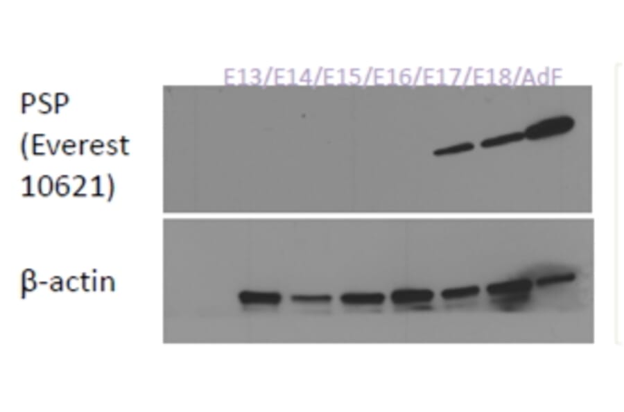 Western Blot - Anti-Parotid Secretory Protein Antibody (A84920) - Antibodies.com