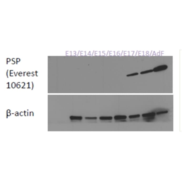 Western Blot - Anti-Parotid Secretory Protein Antibody (A84920) - Antibodies.com
