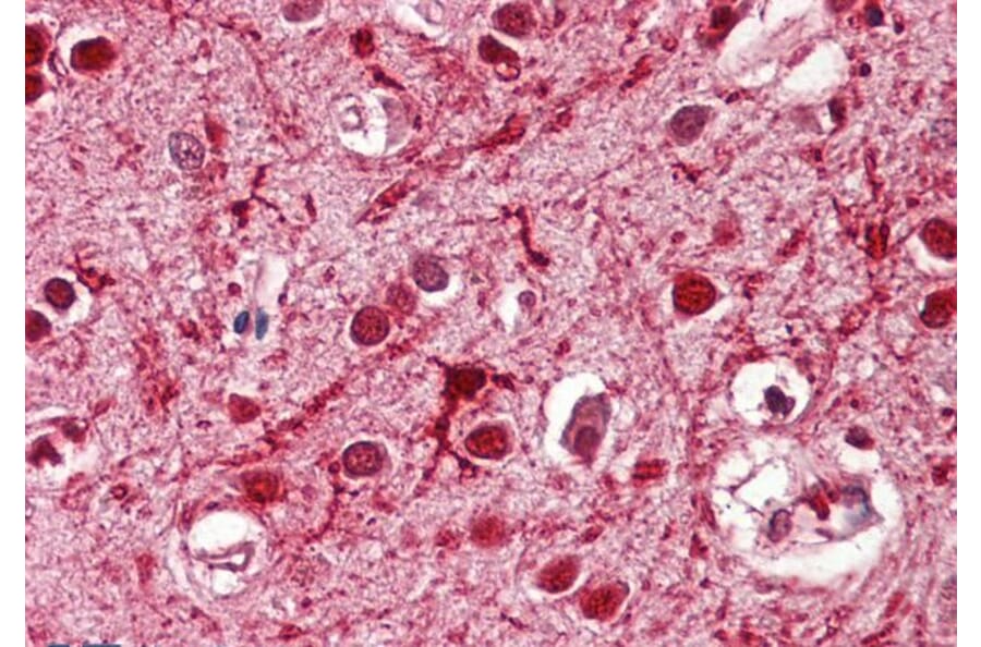 Immunohistochemistry - Anti-Achaete-scute Homolog 3 Antibody (A84922) - Antibodies.com