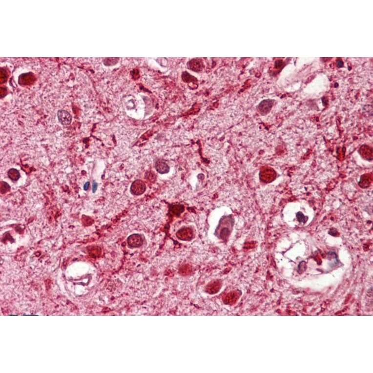 Immunohistochemistry - Anti-Achaete-scute Homolog 3 Antibody (A84922) - Antibodies.com