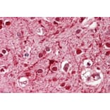 Immunohistochemistry - Anti-Achaete-scute Homolog 3 Antibody (A84922) - Antibodies.com