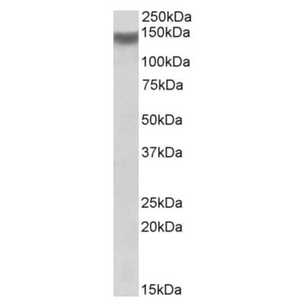 Western Blot - Anti-ITGA11 Antibody (A84923) - Antibodies.com