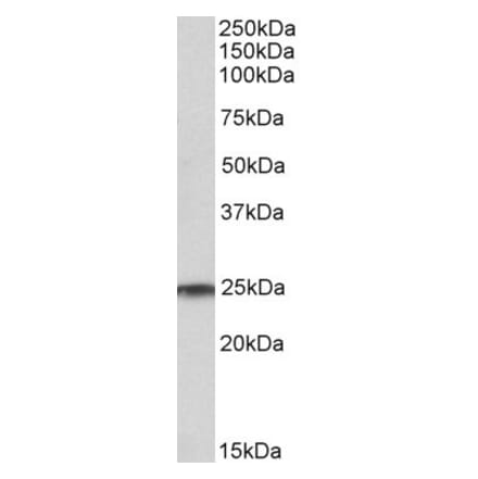 Western Blot - Anti-Ran Antibody (A84924) - Antibodies.com