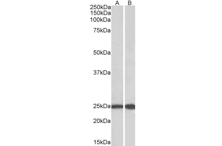 Western Blot - Anti-Ran Antibody (A84924) - Antibodies.com