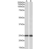 Western Blot - Anti-Ran Antibody (A84924) - Antibodies.com
