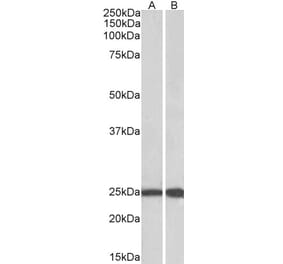 Western Blot - Anti-RAN Antibody (A84924) - Antibodies.com
