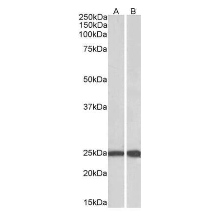 Western Blot - Anti-RAN Antibody (A84924) - Antibodies.com