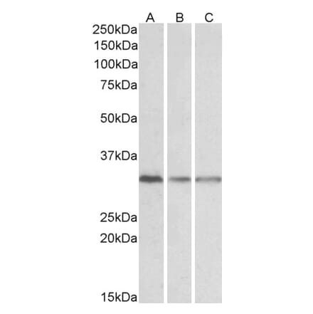 Western Blot - Anti-RACK1 Antibody (A84928) - Antibodies.com