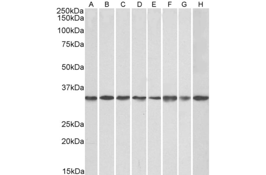 Western Blot - Anti-RACK1 Antibody (A84928) - Antibodies.com