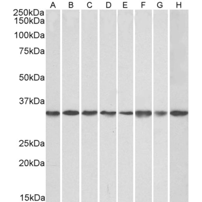 Western Blot - Anti-RACK1 Antibody (A84928) - Antibodies.com
