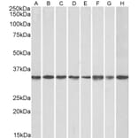 Western Blot - Anti-RACK1 Antibody (A84928) - Antibodies.com