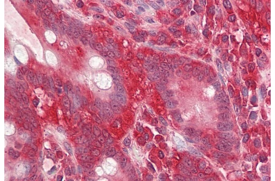 Immunohistochemistry - Anti-RACK1 Antibody (A84928) - Antibodies.com