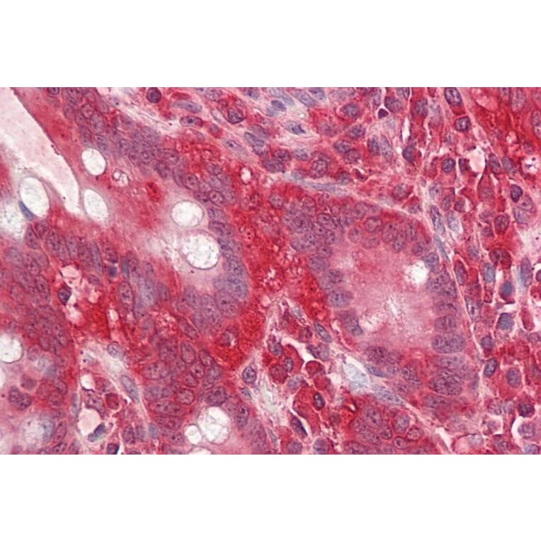 Immunohistochemistry - Anti-RACK1 Antibody (A84928) - Antibodies.com