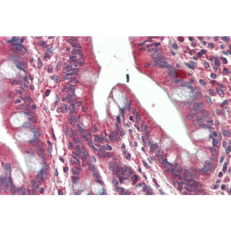 Immunohistochemistry - Anti-SH3GL1 Antibody (A84929) - Antibodies.com