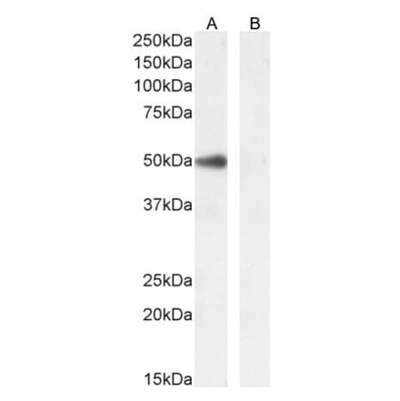 Western Blot - Anti-PAX1 Antibody (A84933) - Antibodies.com