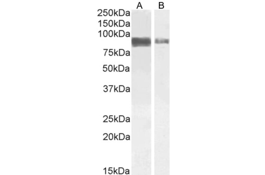Western Blot - Anti-TORC2 Antibody (A84934) - Antibodies.com