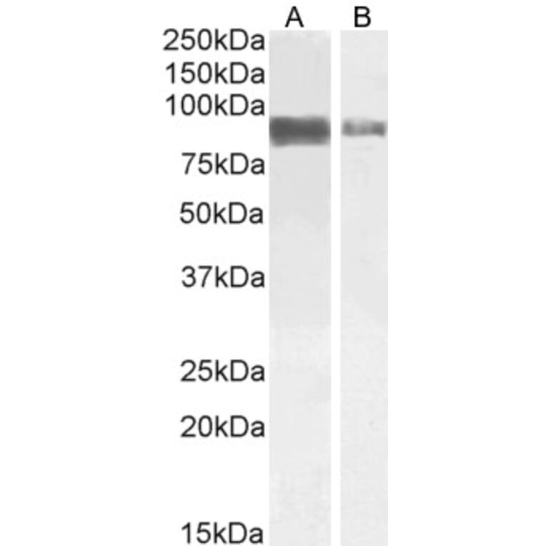 Western Blot - Anti-TORC2 Antibody (A84934) - Antibodies.com