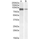 Western Blot - Anti-TORC2 Antibody (A84934) - Antibodies.com