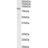 Western Blot - Anti-TORC2 Antibody (A84934) - Antibodies.com