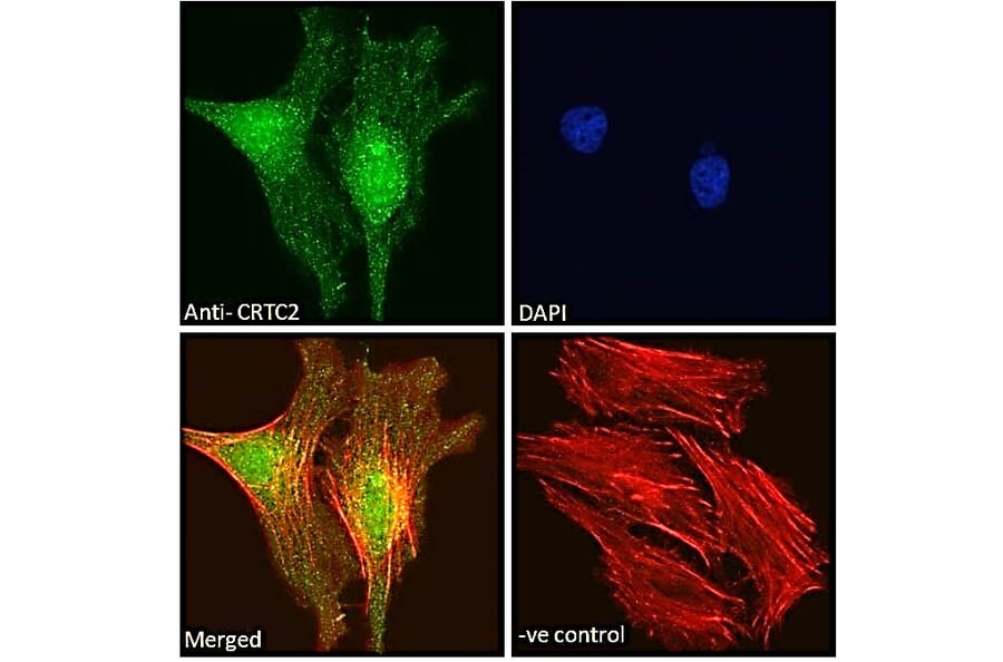 Immunofluorescence - Anti-TORC2 Antibody (A84934) - Antibodies.com