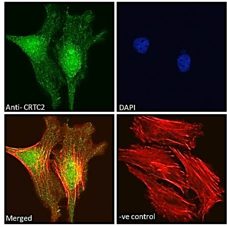 Immunofluorescence - Anti-TORC2 Antibody (A84934) - Antibodies.com
