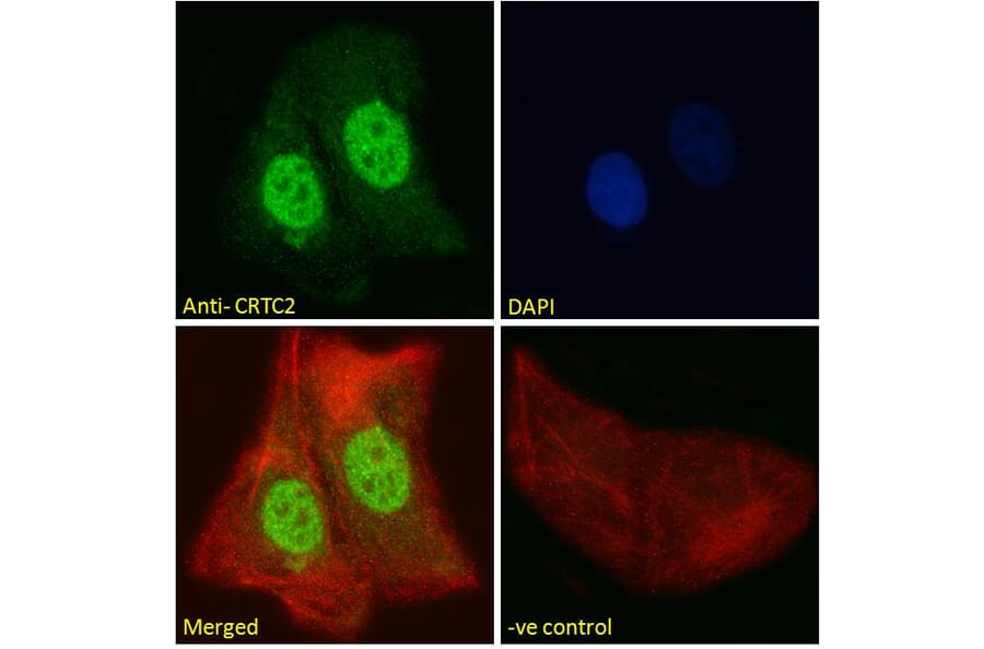 Immunofluorescence - Anti-TORC2 Antibody (A84934) - Antibodies.com