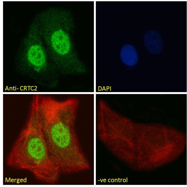 Immunofluorescence - Anti-TORC2 Antibody (A84934) - Antibodies.com