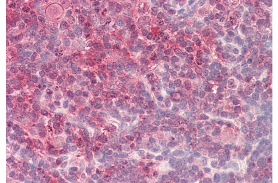 Immunohistochemistry - Anti-TORC2 Antibody (A84935) - Antibodies.com