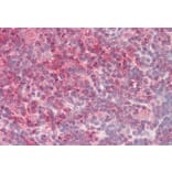 Immunohistochemistry - Anti-TORC2 Antibody (A84935) - Antibodies.com