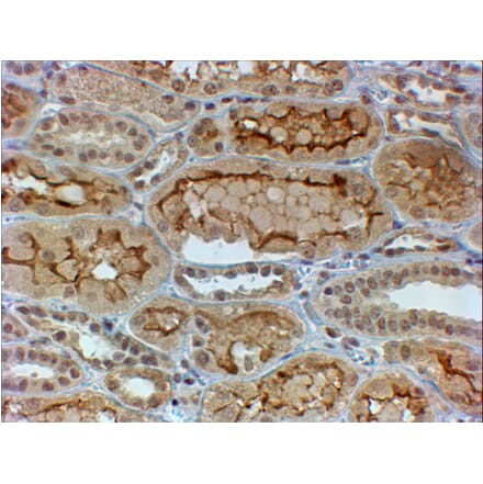 Immunohistochemistry - Anti-COL4A3 Antibody (A84936) - Antibodies.com