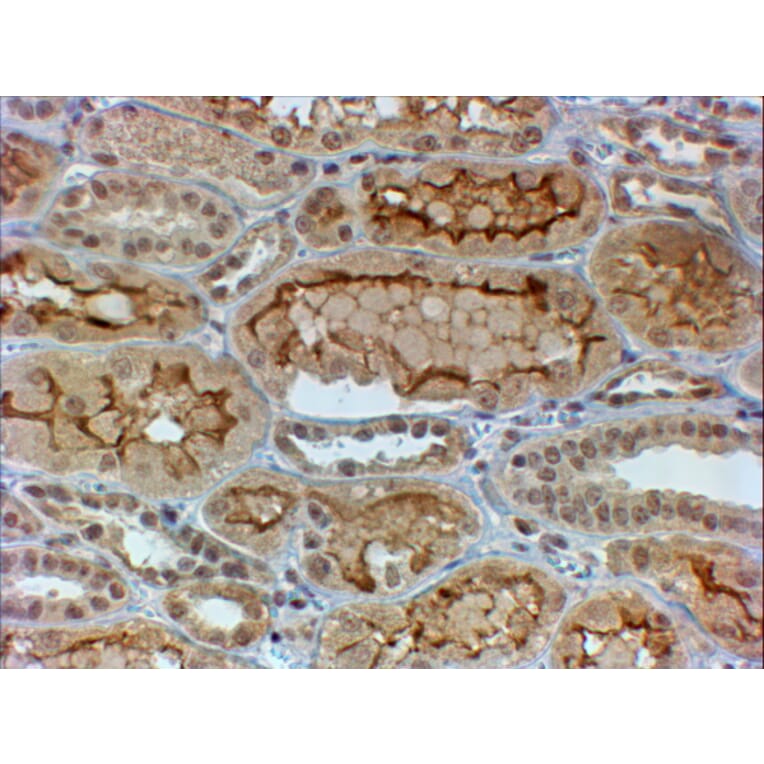 Immunohistochemistry - Anti-COL4A3 Antibody (A84936) - Antibodies.com