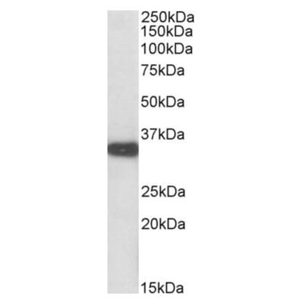 Western Blot - Anti-ASPA Antibody (A84937) - Antibodies.com