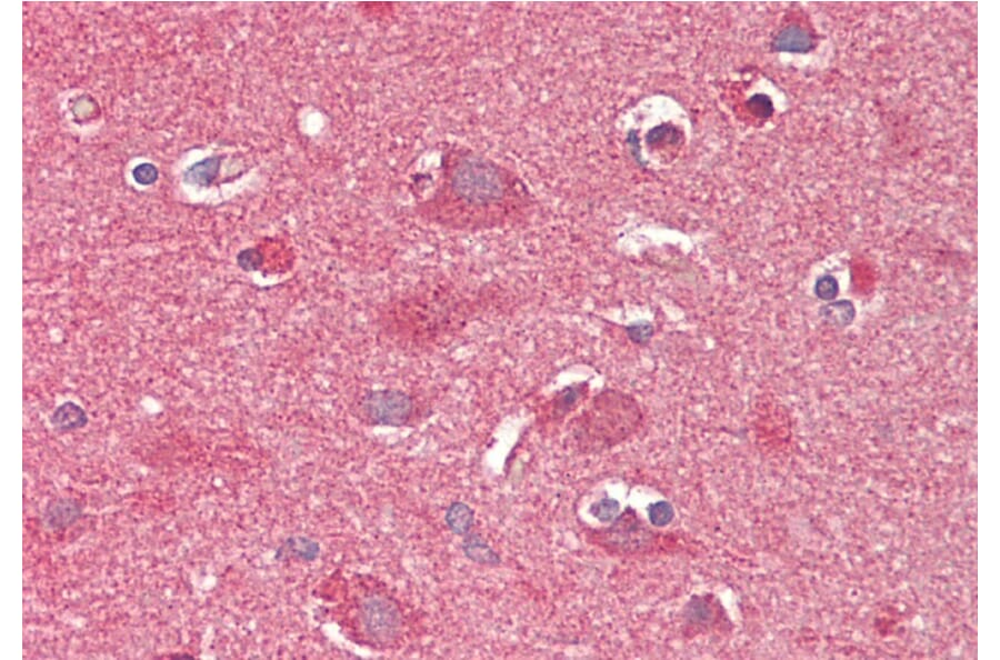 Immunohistochemistry - Anti-CROT/COT Antibody (A84938) - Antibodies.com
