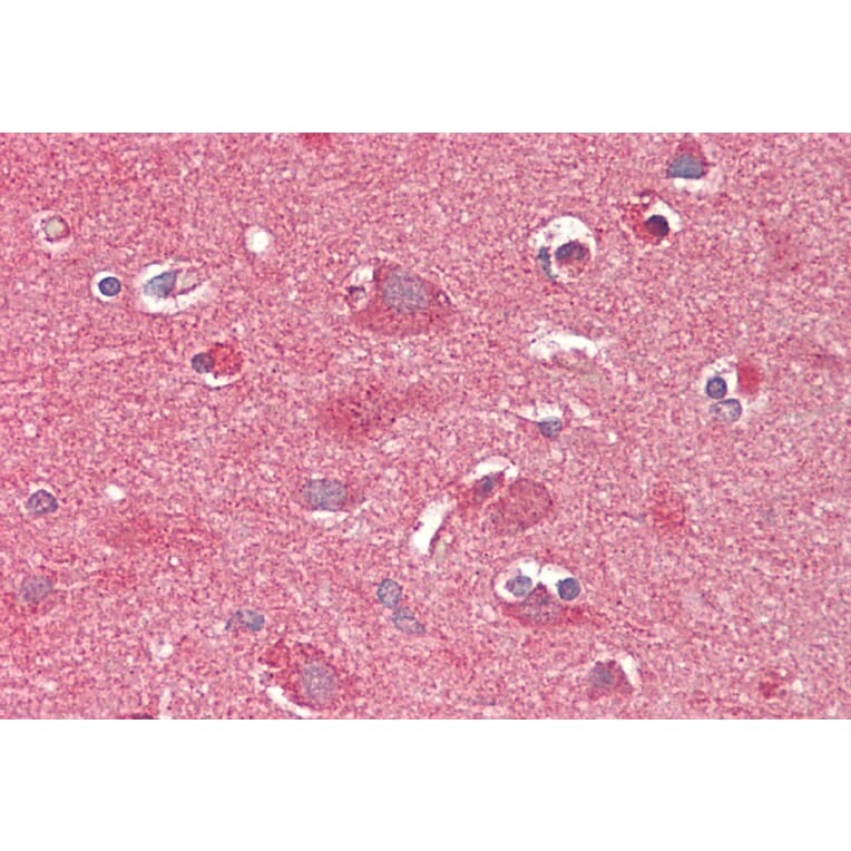 Immunohistochemistry - Anti-CROT/COT Antibody (A84938) - Antibodies.com