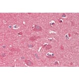 Immunohistochemistry - Anti-CROT/COT Antibody (A84938) - Antibodies.com