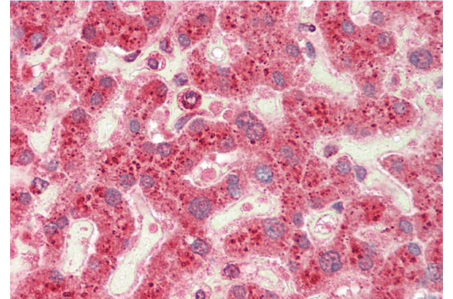 Immunohistochemistry - Anti-CROT/COT Antibody (A84938) - Antibodies.com