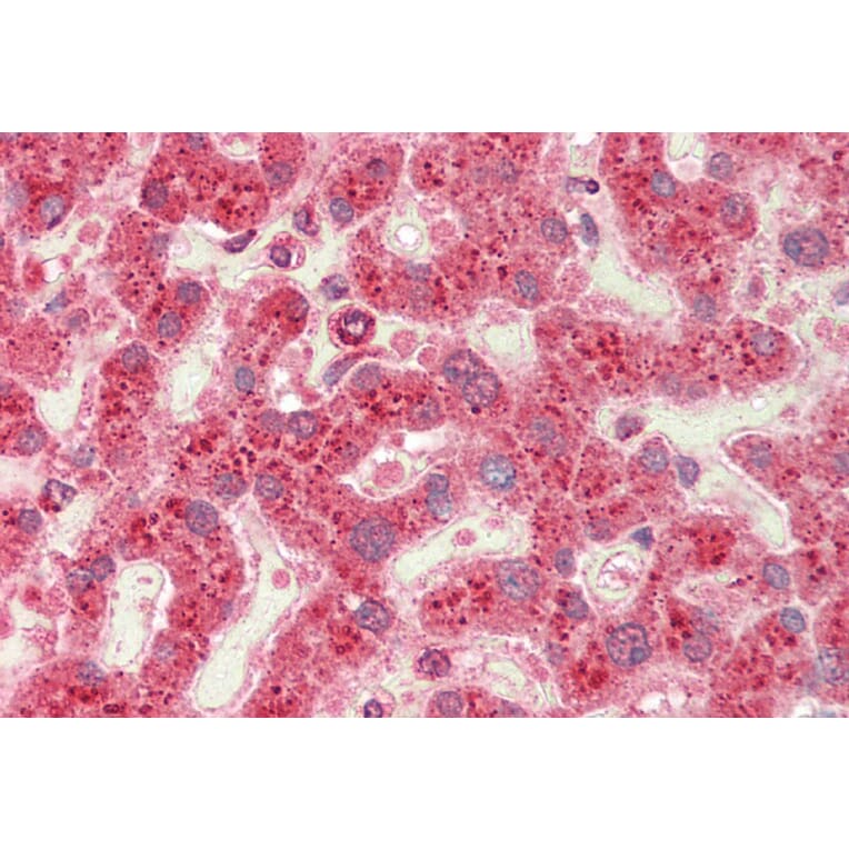 Immunohistochemistry - Anti-CROT/COT Antibody (A84938) - Antibodies.com