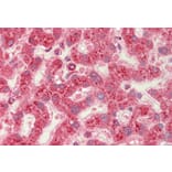 Immunohistochemistry - Anti-CROT/COT Antibody (A84938) - Antibodies.com