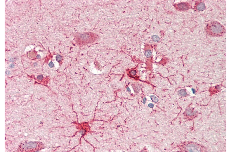 Immunohistochemistry - Anti-CROT/COT Antibody (A84939) - Antibodies.com