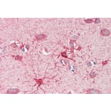 Immunohistochemistry - Anti-CROT/COT Antibody (A84939) - Antibodies.com
