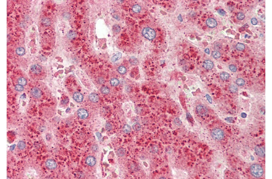 Immunohistochemistry - Anti-CROT/COT Antibody (A84939) - Antibodies.com