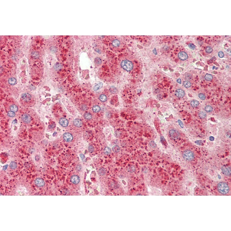 Immunohistochemistry - Anti-CROT/COT Antibody (A84939) - Antibodies.com