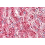Immunohistochemistry - Anti-CROT/COT Antibody (A84939) - Antibodies.com