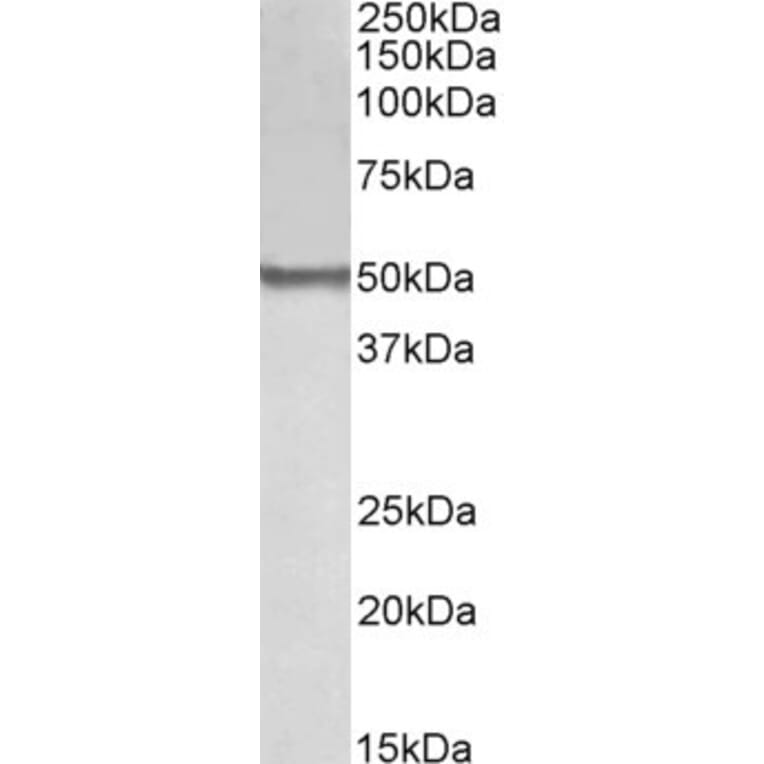 Western Blot - Anti-BLK Antibody (A84940) - Antibodies.com