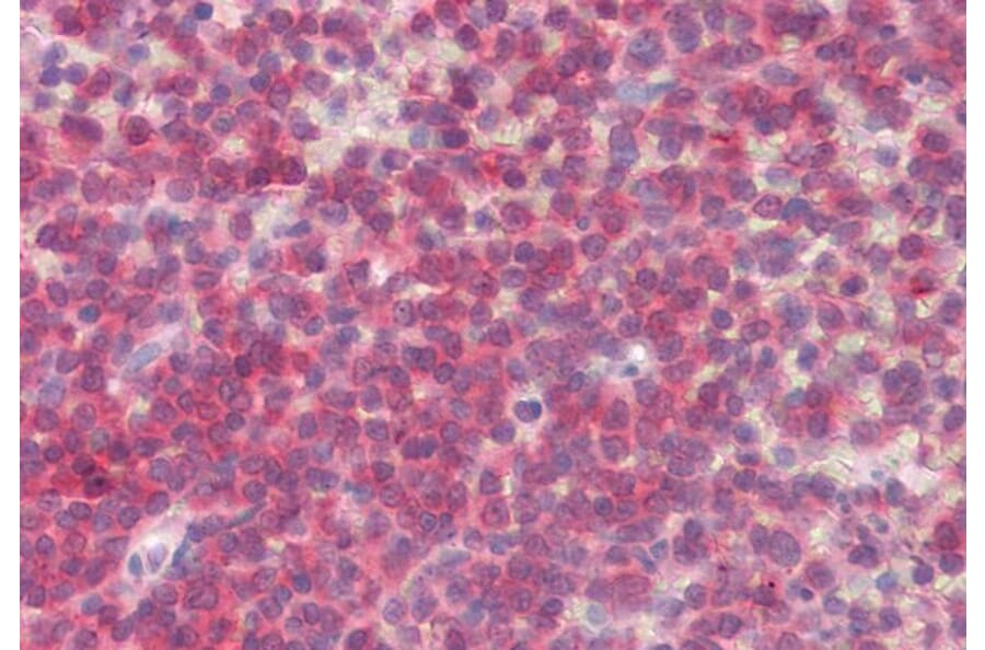 Immunohistochemistry - Anti-BLK Antibody (A84940) - Antibodies.com