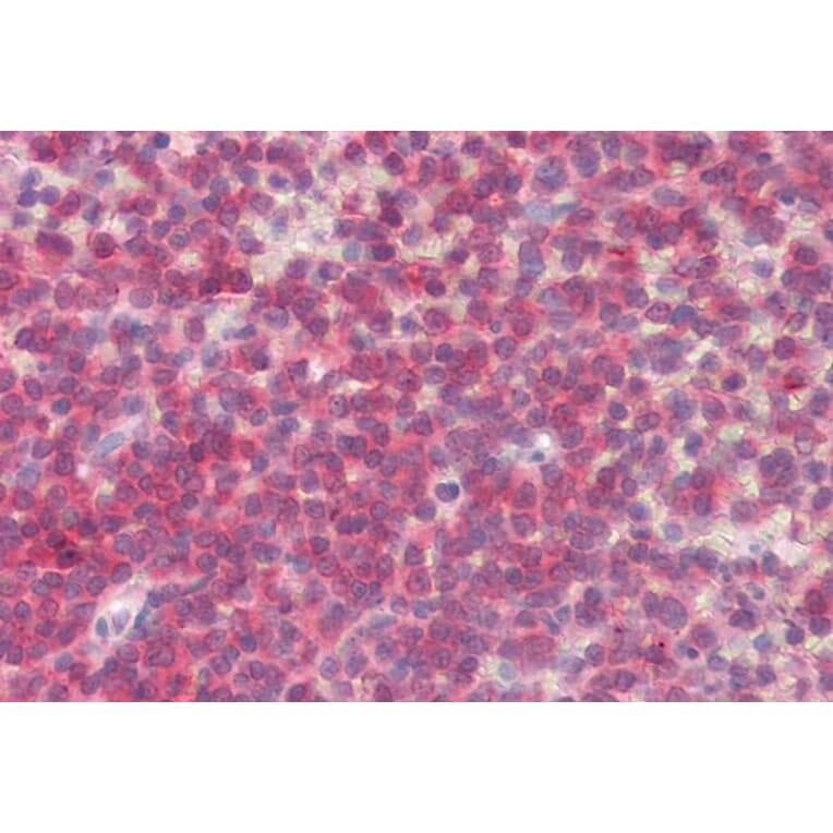 Immunohistochemistry - Anti-BLK Antibody (A84940) - Antibodies.com