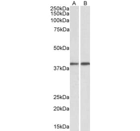 Western Blot - Anti-GNAQ Antibody (A84941) - Antibodies.com