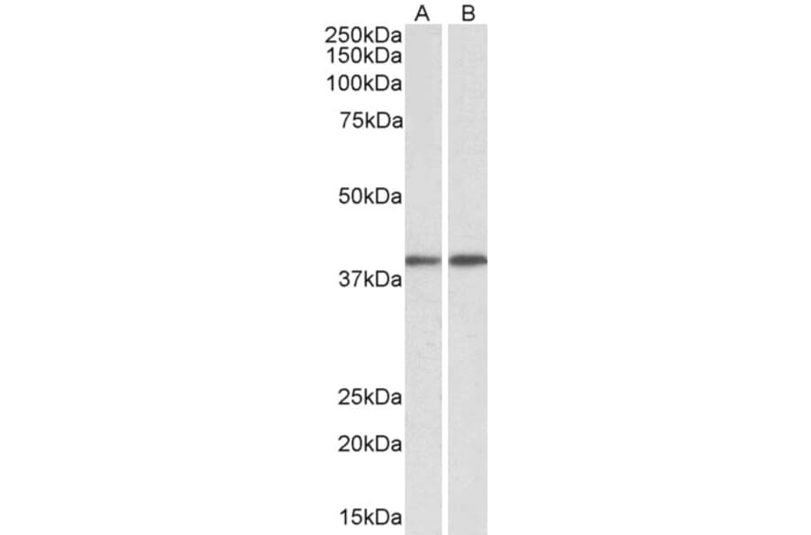 Western Blot - Anti-GNAQ Antibody (A84941) - Antibodies.com