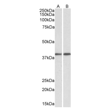 Western Blot - Anti-GNAQ Antibody (A84941) - Antibodies.com