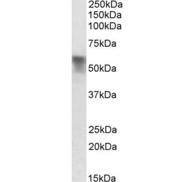 Western Blot - Anti-Cortisol Binding Globulin Antibody (A84943) - Antibodies.com